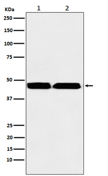 KMT1B / SUV39H2 Rabbit mAb Antibody