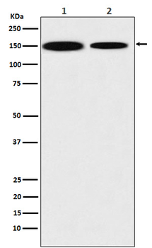 KDM4A Rabbit mAb Antibody