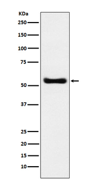 KAT8 / MYST1 / MOF Rabbit mAb
