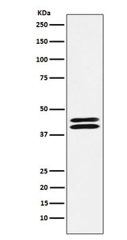 PON2 Rabbit mAb Antibody