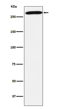 PRPF8 Rabbit mAb Antibody