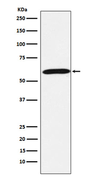 Calsequestrin 1 Rabbit mAb