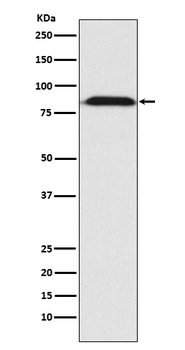 Furin Rabbit mAb Antibody