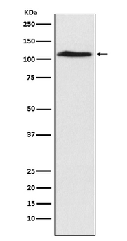 CHD1L Rabbit mAb Antibody