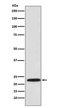 PSMB8 / LMP7 Rabbit mAb Antibody