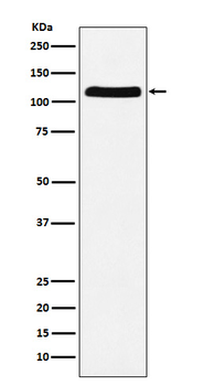 E1 Ubiquitin Activating Enzyme Rabbit mAb