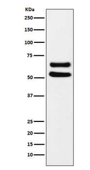 Ikaros Rabbit mAb Antibody