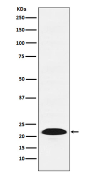 PSB9 / LMP2 Rabbit mAb Antibody