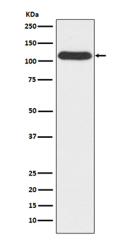 OGT Rabbit mAb Antibody