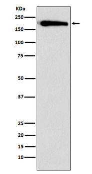 SMARCC1/BAF155 Rabbit mAb Antibody
