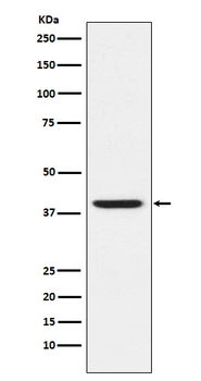 RING2 / RING1B / RNF2 Rabbit mAb Antibody