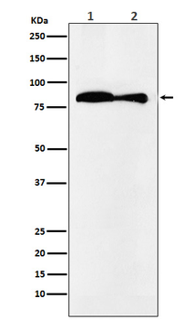 VPS35 Rabbit mAb