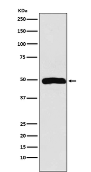 Arp3 Rabbit mAb [KD Validated]