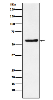 DKC1 Rabbit mAb Antibody