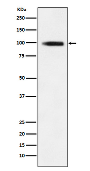 GIT1 Rabbit mAb Antibody
