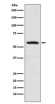 alpha Internexin Rabbit mAb Antibody