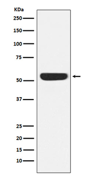 CAMKIV Rabbit mAb Antibody