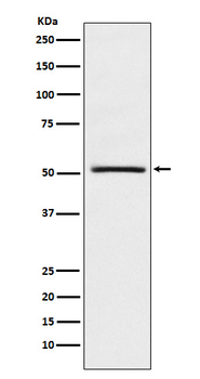 NR0B1 / DAX1 Rabbit mAb Antibody