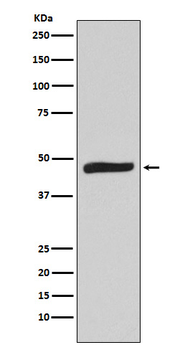 MAPKAP Kinase 2 Rabbit mAb [KD Validated]
