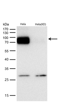 FOXO1 Rabbit mAb [KD Validated] Antibody