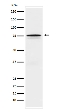 FOXO1 Rabbit mAb [KD Validated] Antibody