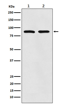 TPOR Rabbit mAb Antibody