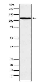 HAUSP / USP7 Rabbit mAb [KD Validated]