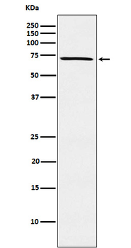 MELK Rabbit mAb Antibody