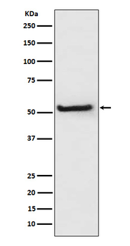 TXNIP Rabbit mAb Antibody