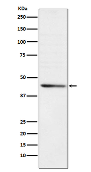 RRM2 Rabbit Monoclonal Antibody