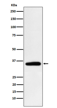Pyruvate Dehydrogenase E1 beta subunit Rabbit mAb Antibody