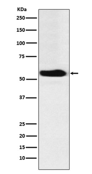 FTO Rabbit mAb Antibody