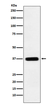 TMEM173 Rabbit Monoclonal Antibody