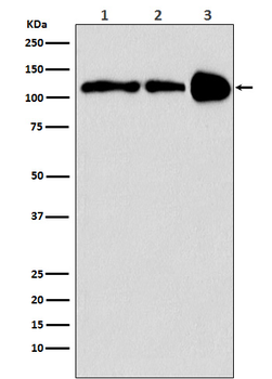 PGC1 beta Rabbit mAb Antibody