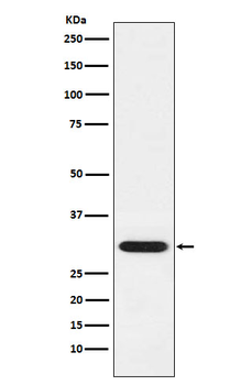 GCLM Rabbit mAb Antibody
