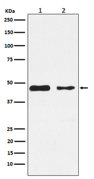 PDK2 Rabbit mAb