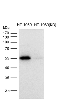 PFKFB3 Rabbit mAb [KD Validated]