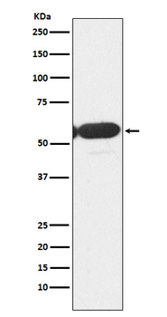 PFKFB3 Rabbit mAb [KD Validated]