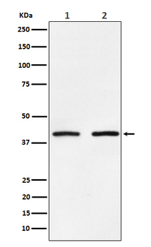 SMYD3 Rabbit mAb Antibody