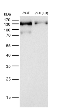JAK1 Rabbit mAb [KD Validated]