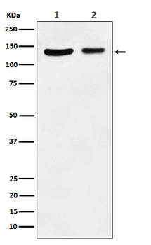 JAK1 Rabbit mAb [KD Validated]