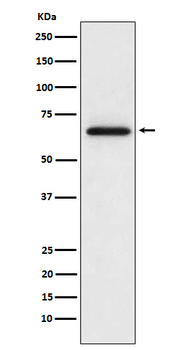 MMP2 Rabbit mAb Antibody
