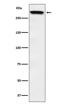 Huntingtin Rabbit mAb Antibody