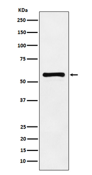 PAK2 Rabbit mAb Antibody