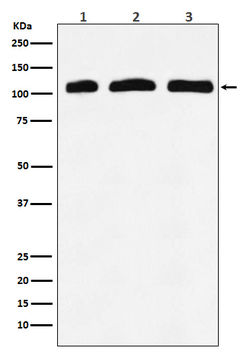 PI 3 Kinase p110 delta Rabbit Monoclonal Antibody