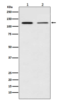 NFkB p100/p52 Rabbit Monoclonal Antibody