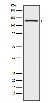 USP28 Rabbit Monoclonal Antibody
