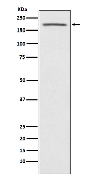 ACE1 Rabbit mAb Antibody