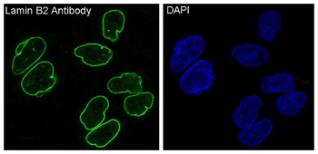 Lamin B2 Rabbit mAb  [KD Validated]
