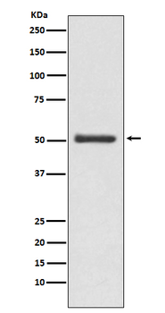 LOXL2 Rabbit mAb  [KD Validated]